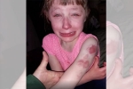 wisconsin, Lynn Waldron-Moehle, 10 year old special needs child brutally bitten on arm while returning home in school bus, Special needs