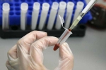 Human Antibodies To Fight Ebola, Ebola, new human antibodies to combat ebola, Sudan virus