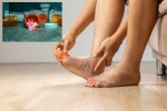 Gout Drugs latest update, Gout Drugs breaking, gout drugs may cut the risk of heart attack, Usa