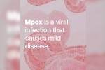 mpox break down, mpox in Africa, mpox emergency again, Mpox mpox break down, mpox in Africa, mpox emergency again, Mpox