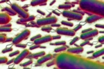 E.coli Outbreak symptoms, E.coli, all about e coli outbreak in the united kingdom, Manto