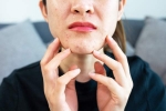 Stress Acne relief, Stress Acne symptoms, does your regular routine cause you acne, Stress acne