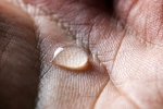 10 Ways To Treat Sweaty Hands And Feet, Sweaty Hands And Feet, 10 ways to treat sweaty hands and feet, Black tea